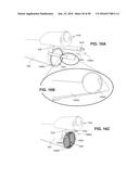 ENDOSCOPE WITH SHARED WORKING CHANNEL diagram and image