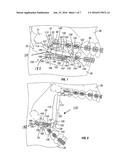 Mandibular repositioning device diagram and image