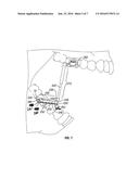 Mandibular repositioning device diagram and image