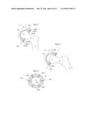 HIP JOINT DEVICE AND METHOD diagram and image