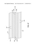 TAMPON METHOD OF MANUFACTURE diagram and image