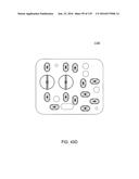 HEMODIALYSIS SYSTEMS AND METHODS diagram and image