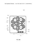 HEMODIALYSIS SYSTEMS AND METHODS diagram and image