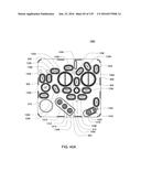 HEMODIALYSIS SYSTEMS AND METHODS diagram and image