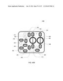 HEMODIALYSIS SYSTEMS AND METHODS diagram and image