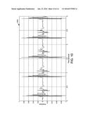 PACING DEVICE WITH ACOUSTIC SENSOR diagram and image