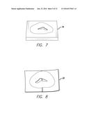 PROSTHETIC APPLIANCE KIT diagram and image