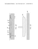 PROSTHETIC APPLIANCE KIT diagram and image