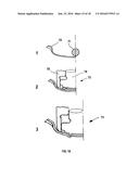 EMBOSSING METHOD AND APPARATUS diagram and image