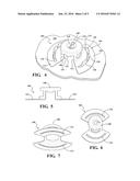 HEAT STAKE ATTACHMENT FEATURE diagram and image