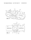 HEAT STAKE ATTACHMENT FEATURE diagram and image