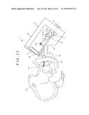 MEDICAL TOOL AND PUNCTURE METHOD diagram and image