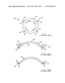 CORNEAL IMPLANT AND METHOD OF DELIVERING A CORNEAL IMPLANT diagram and image