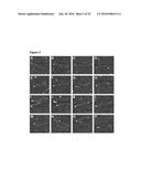 MODIFIED CASCADE RIBONUCLEOPROTEINS AND USES THEREOF diagram and image