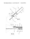 Handpiece for treating wounds diagram and image