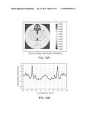 SYSTEMS AND METHODS FOR FLUID TREATMENT WITH HOMOGENEOUS DISTRIBUTION OF     ULTRAVIOLET LIGHT diagram and image