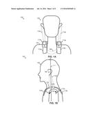 NON-OCCLUDED PERSONAL AUDIO AND COMMUNICATION SYSTEM diagram and image