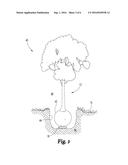 SYSTEMS AND METHODS FOR CONTROLLING PEST INFESTATION OF A WOODY PLANT diagram and image