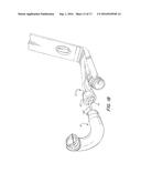 Sealed Connection For Fluid Conduit Parts diagram and image