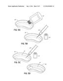 SOLUTIONS FOR INCREASING THE STABILITY AND SHELF LIFE OF AN ORGAN AND     TISSUE PRESERVATION SOLUTION diagram and image