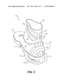 Method Including Footwear And Sock Having Aligning Indicia diagram and image