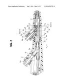 ENDOSCOPE diagram and image