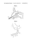 TREATMENT METHOD diagram and image