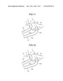 TREATMENT METHOD diagram and image