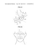 TREATMENT METHOD diagram and image