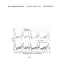 ELECTROCARDIOGRAM SIGNAL DETECTION diagram and image