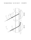 Vascular Closure Devices and Methods Providing Hemostatic Enhancement diagram and image