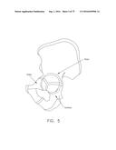 METHOD AND APPARATUS FOR TREATING A HIP JOINT, INCLUDING THE PROVISION AND     USE OF A NOVEL SUTURE PASSER diagram and image