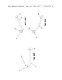 METHOD AND APPARATUS FOR TREATING A HIP JOINT, INCLUDING THE PROVISION AND     USE OF A NOVEL SUTURE PASSER diagram and image