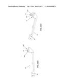 METHOD AND APPARATUS FOR TREATING A HIP JOINT, INCLUDING THE PROVISION AND     USE OF A NOVEL SUTURE PASSER diagram and image