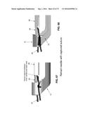 METHOD AND APPARATUS FOR TREATING A HIP JOINT, INCLUDING THE PROVISION AND     USE OF A NOVEL SUTURE PASSER diagram and image