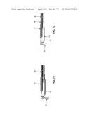 METHOD AND APPARATUS FOR TREATING A HIP JOINT, INCLUDING THE PROVISION AND     USE OF A NOVEL SUTURE PASSER diagram and image