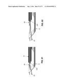 METHOD AND APPARATUS FOR TREATING A HIP JOINT, INCLUDING THE PROVISION AND     USE OF A NOVEL SUTURE PASSER diagram and image