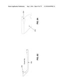 METHOD AND APPARATUS FOR TREATING A HIP JOINT, INCLUDING THE PROVISION AND     USE OF A NOVEL SUTURE PASSER diagram and image