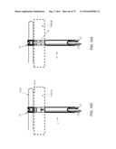 METHOD AND APPARATUS FOR TREATING A HIP JOINT, INCLUDING THE PROVISION AND     USE OF A NOVEL SUTURE PASSER diagram and image