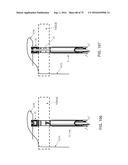 METHOD AND APPARATUS FOR TREATING A HIP JOINT, INCLUDING THE PROVISION AND     USE OF A NOVEL SUTURE PASSER diagram and image