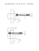 METHOD AND APPARATUS FOR TREATING A HIP JOINT, INCLUDING THE PROVISION AND     USE OF A NOVEL SUTURE PASSER diagram and image