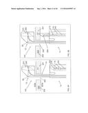 Medical Device Having a Position Indicator diagram and image