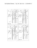 Medical Device Having a Position Indicator diagram and image