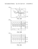 SURGICAL INCISION AND CLOSURE APPARATUS diagram and image