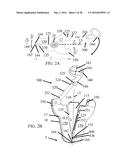 Devices and Methods for Removing Unwanted Tissue diagram and image