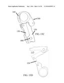 Devices and Methods for Removing Unwanted Tissue diagram and image