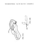 Devices and Methods for Removing Unwanted Tissue diagram and image