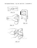 Devices and Methods for Removing Unwanted Tissue diagram and image