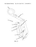 Devices and Methods for Removing Unwanted Tissue diagram and image