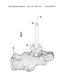 MEDICAL INSTRUMENTATION diagram and image